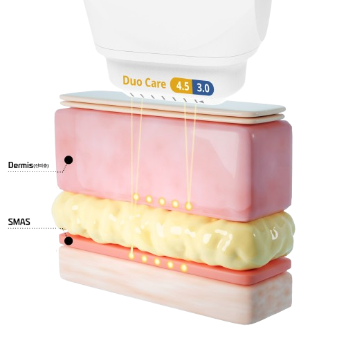 Duo 4.5 - 3 dermis layer targeting